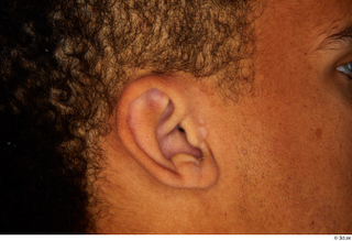 Garson ear 0003.jpg